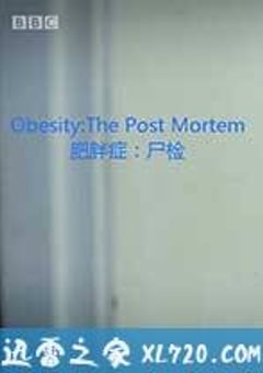 解剖肥胖 Obesity: The Post Mortem (2016) [迅雷BT磁力免费下载]