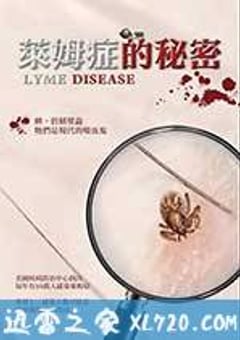 莱姆症的秘密 (2017) [迅雷BT磁力免费下载]